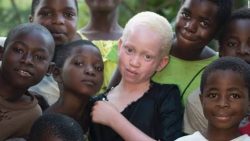 Albinos